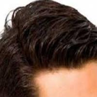 Hair Replacement Services In Hyderabad