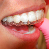Retainers In Faridabad