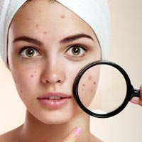 Skin Diseases Ayurvedic Treatment