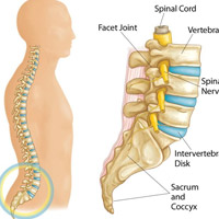 Lumbar Spondylitis Treatment