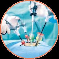 Laparoscopic Surgery Services