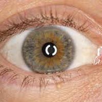 Artificial Eyes In Ambala
